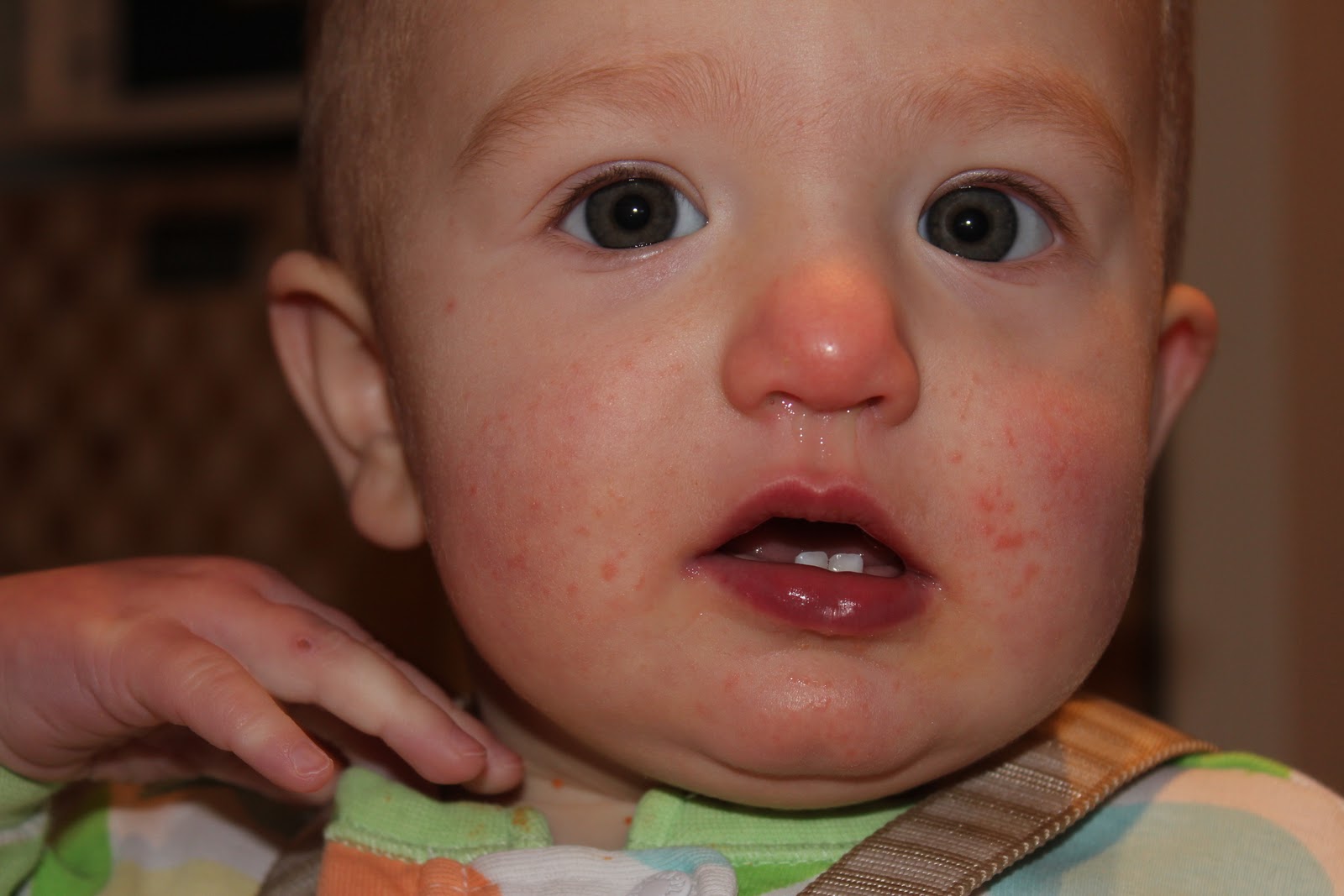 У ребенка забит нос соплями. Красный нос у младенца.