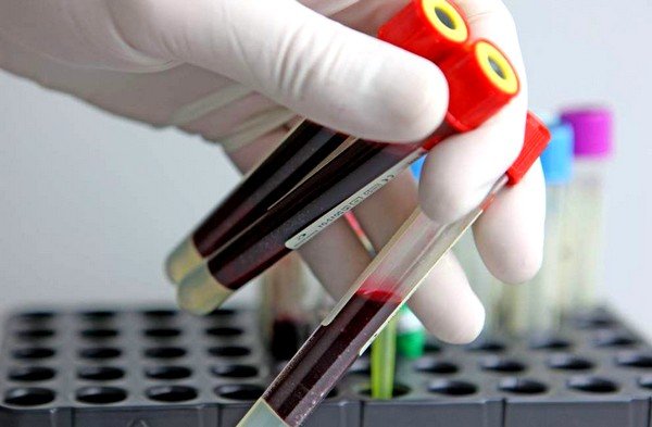Анализ крови может свидетельствовать об интоксикации организма