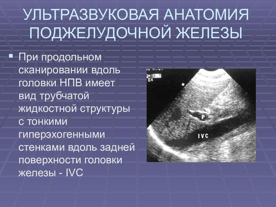  Ультразвуковое исследование поджелудочной железы