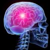 Сужение сосудов головного мозга: причины, симптомы, лечение народными средствами