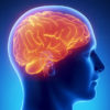 Атеросклероз сосудов головного мозга: причины, симптомы и лечение в домашних условиях