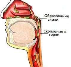 скопление слизи в горле