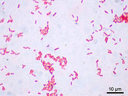 Escherichia coli Gram.jpg