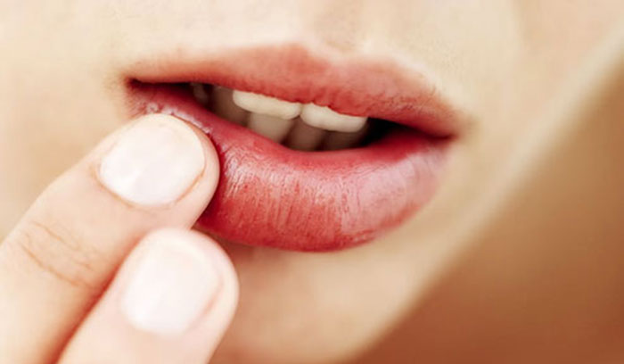 частые простуды на губах у взрослых