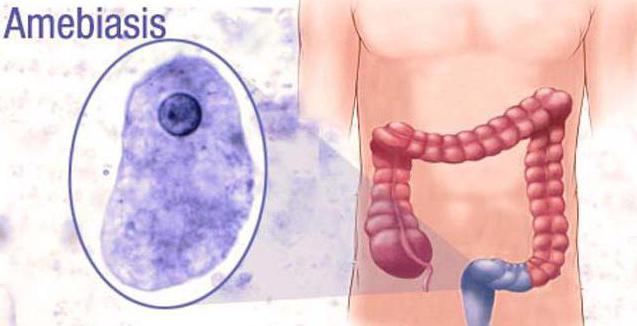 признаки амебиаза кишечного