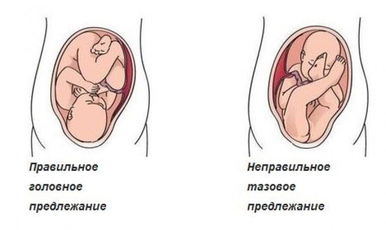 ребенок находится справа в животе