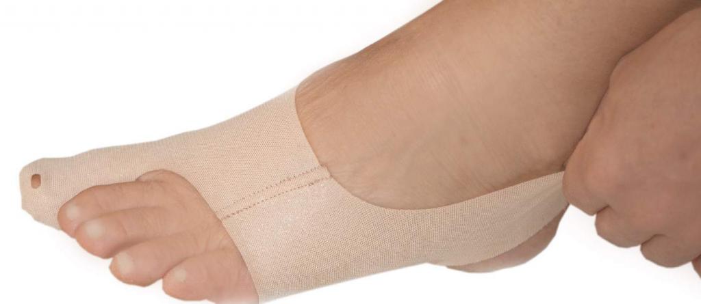 лечение шишки на пальцах ног