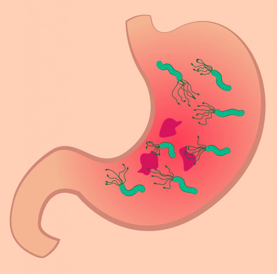 хеликобактер пилори норма в крови в цифрах