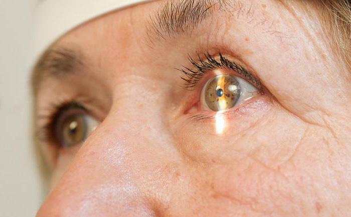 капли при начальной стадии катаракты
