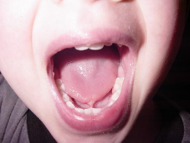 анатомия полости рта человека 