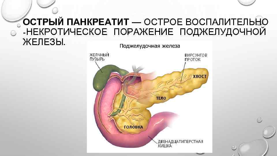 Патологии поджелудочной железы презентация