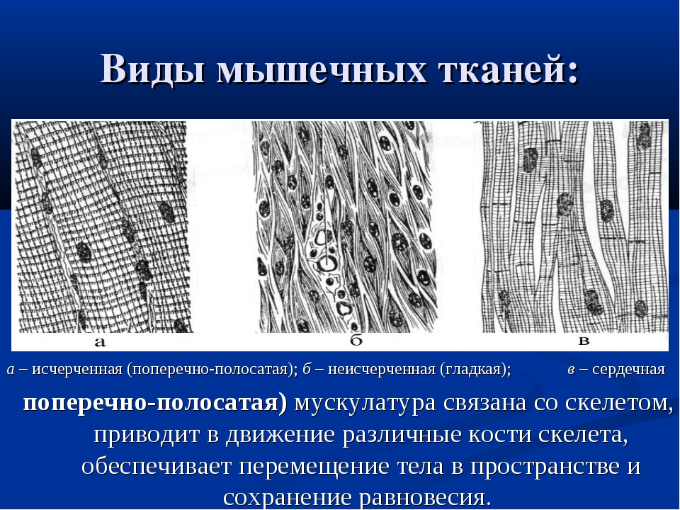 В поперечнополосатой мышечной ткани клетки какие. Скелетная сердечная и гладкая мышечная ткань. Поперечно-полосатая Скелетная мышечная ткань схема. Поперечно исчерченная Скелетная мышечная ткань. Строение поперечно полосатой скелетной мышечной ткани.