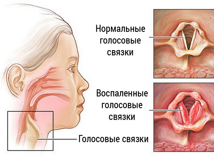 Схема