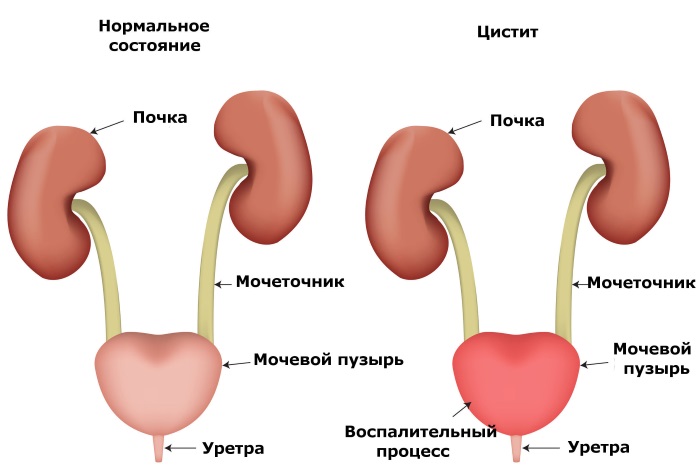 Что делать, если болит живот в области пупка и ниже. Причины и как лечить у ребенка, взрослого, при беременности