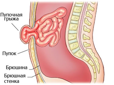 Что делать, если болит живот в области пупка и ниже. Причины и как лечить у ребенка, взрослого, при беременности