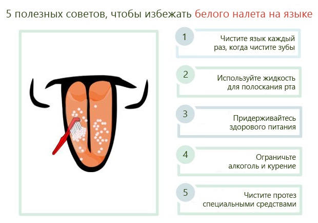 Белый язык у взрослого. Причины и лечение народными средствами. Симптомы, признаки