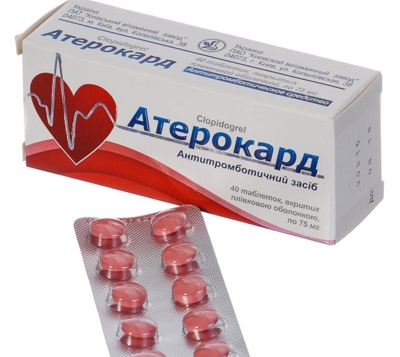 Препараты от сердца без рецептов в таблетках. Список, названия на русском языке. Цены