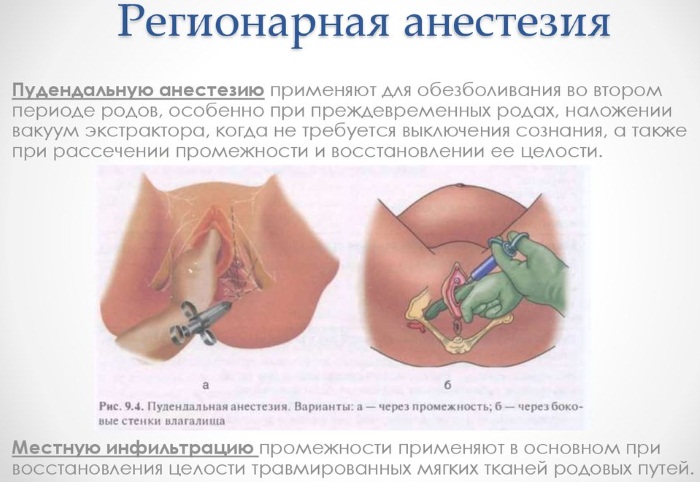 Местная анестезия в хирургии. Что это такое, препараты, показания, противопоказания