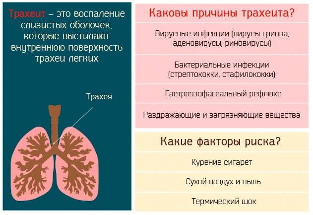 Гранулезный фарингит. Лечение у взрослых, ребенка, симптомы, опасен ли, как долго проходит