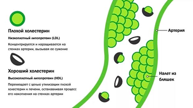 плохой и хороший холестерин в артерии как влияет холестерина в яйцах