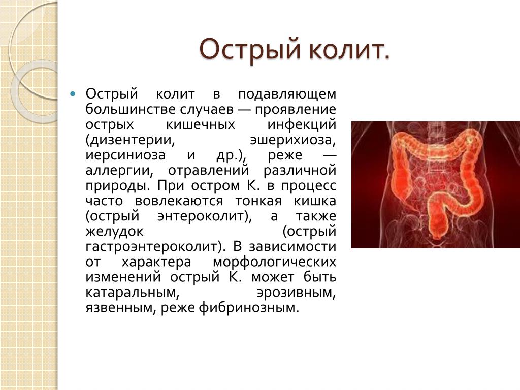 Хронический колит кишечника картинки