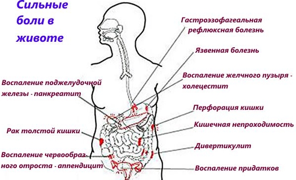 Что делать если постоянно болит желудок