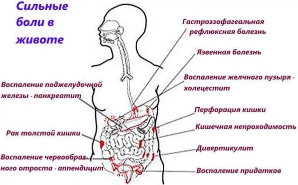 Что делать когда болит кишечник внизу живота