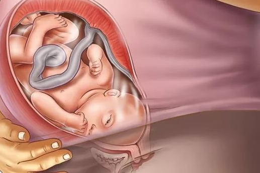 понос и рвота на 39 недели беременности