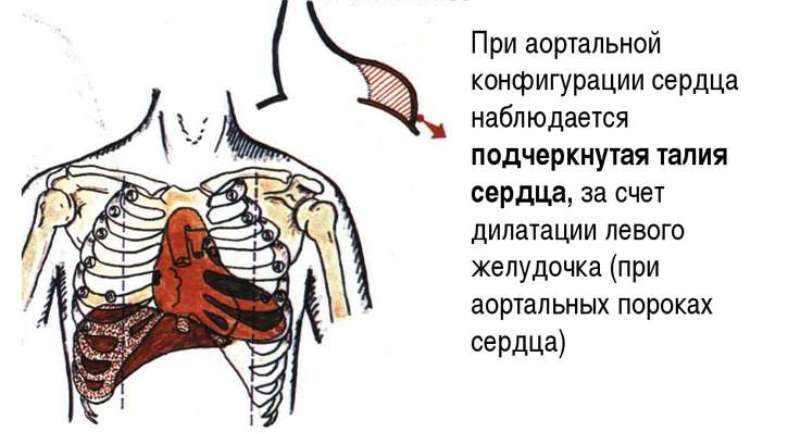 Сердце с левой стороны. Левая сторона грудной клетки. Сердце человека расположено между ребрами. Сердце находится под ребрами. Под каким ребром находится сердце.