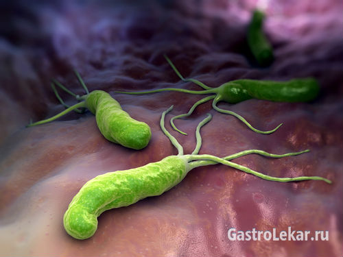 Язва желудка вызванная бактерией Хеликобактер