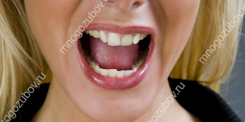 синдром жжения во рту и его причины
