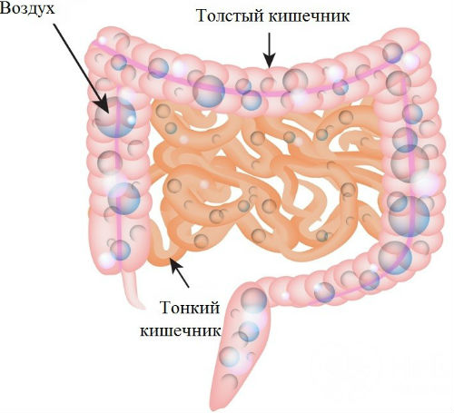 газы в кишечнике