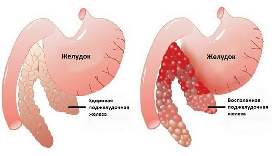 поджелудочная железа для чего нужна