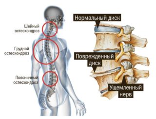 Болит между ребер посередине спереди