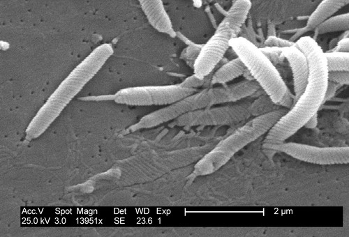 Хеликобактерия под микроскопом