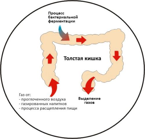 Причины повышенного метеоризма