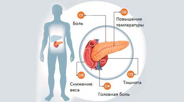 симптомы заболевания ПЖ