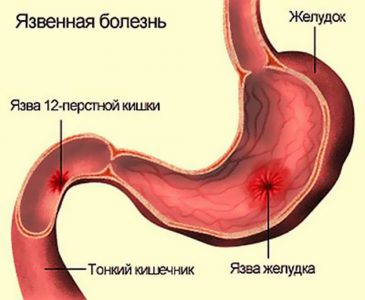 Иллюстрация 1