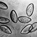 яйца гельминтов под микроскопом
