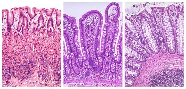Слизистая желудка, тонкой и толстой кишки (слева направо)