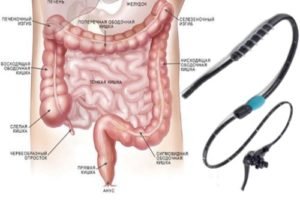 Jenteroskopija-kishechnika