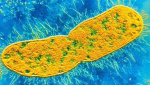 Бактерия Клебсиелла