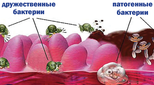 Микрофлора кишечника