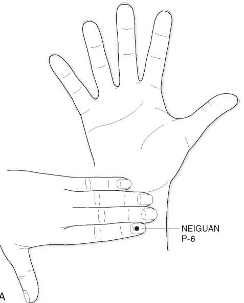 Точка p 6. Точка Neiguan p6. Точки при тошноте. Точки от тошноты. Точка от тошноты на руке.