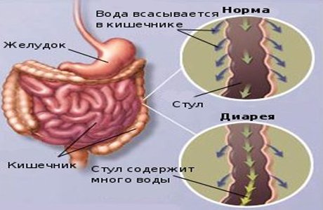 Норма и диарея в кишечнике