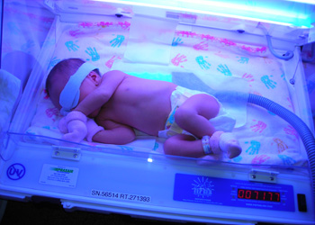 как снизить билирубин у новорожденного