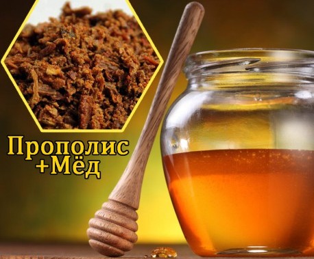 mozhno-li-pit-propolis-pri-gastrite-propolis-s-medom-i-molokom