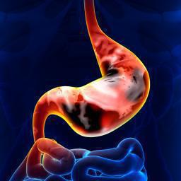 как курение влияет на желудок