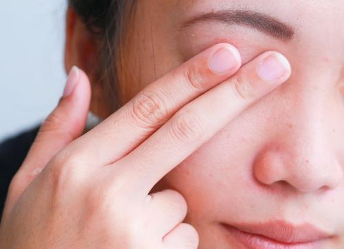 Как избавиться от опухших глаз от слез быстро в домашних условиях. Оказание первой помощи