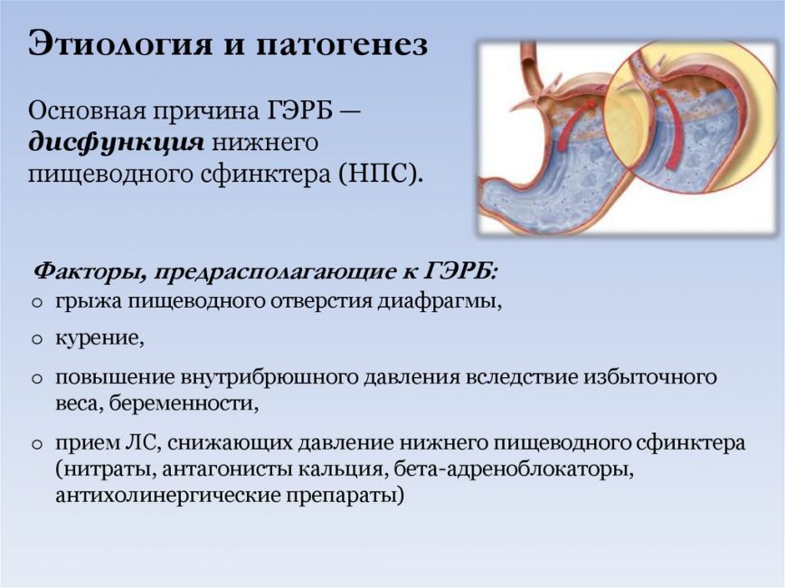 Причины и механизм развития ГЭРБ